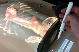 Research project “MedProjection”